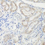 Immunohistochemistry - Anti-VDAC1 Antibody (A11242) - Antibodies.com