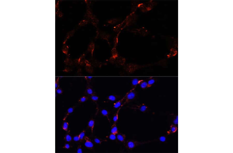 Immunofluorescence - Anti-VDAC1 Antibody (A11242) - Antibodies.com