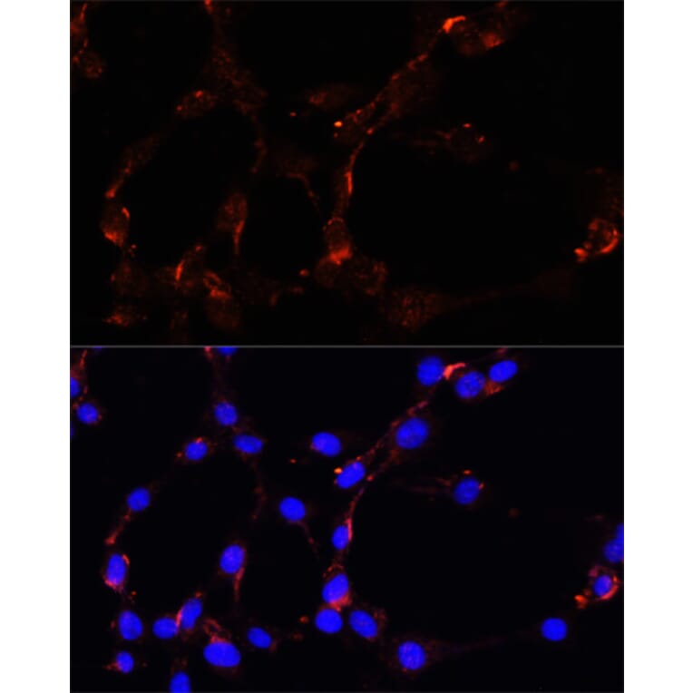 Immunofluorescence - Anti-VDAC1 Antibody (A11242) - Antibodies.com