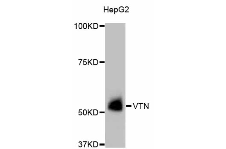 Western Blot - Anti-VTN Antibody (A11245) - Antibodies.com
