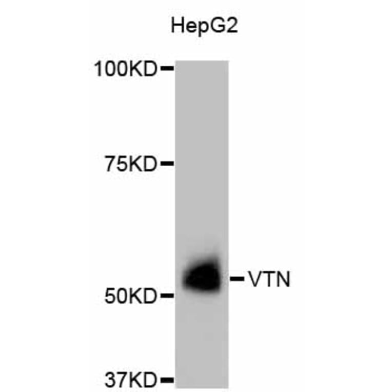 Western Blot - Anti-VTN Antibody (A11245) - Antibodies.com