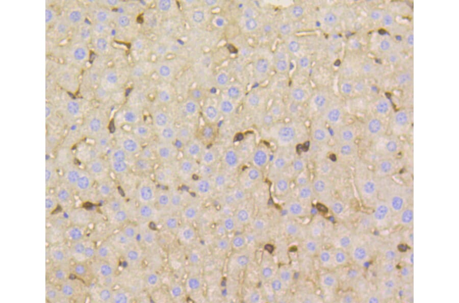 Immunohistochemistry - Anti-VTN Antibody (A11245) - Antibodies.com