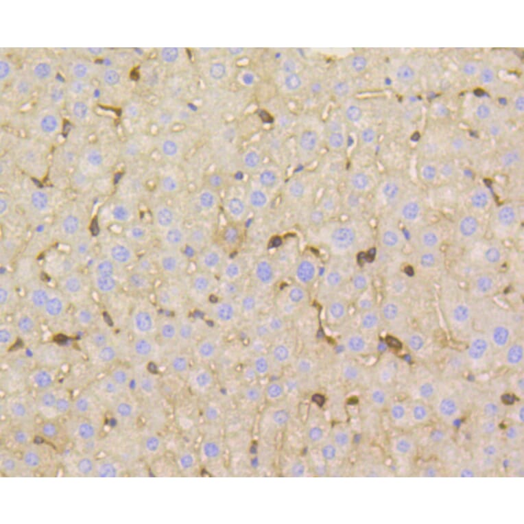 Immunohistochemistry - Anti-VTN Antibody (A11245) - Antibodies.com