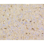Immunohistochemistry - Anti-VTN Antibody (A11245) - Antibodies.com