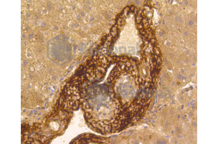 Immunohistochemistry - Anti-VTN Antibody (A11245) - Antibodies.com