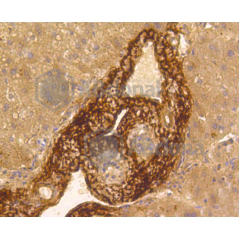 Immunohistochemistry - Anti-VTN Antibody (A11245) - Antibodies.com