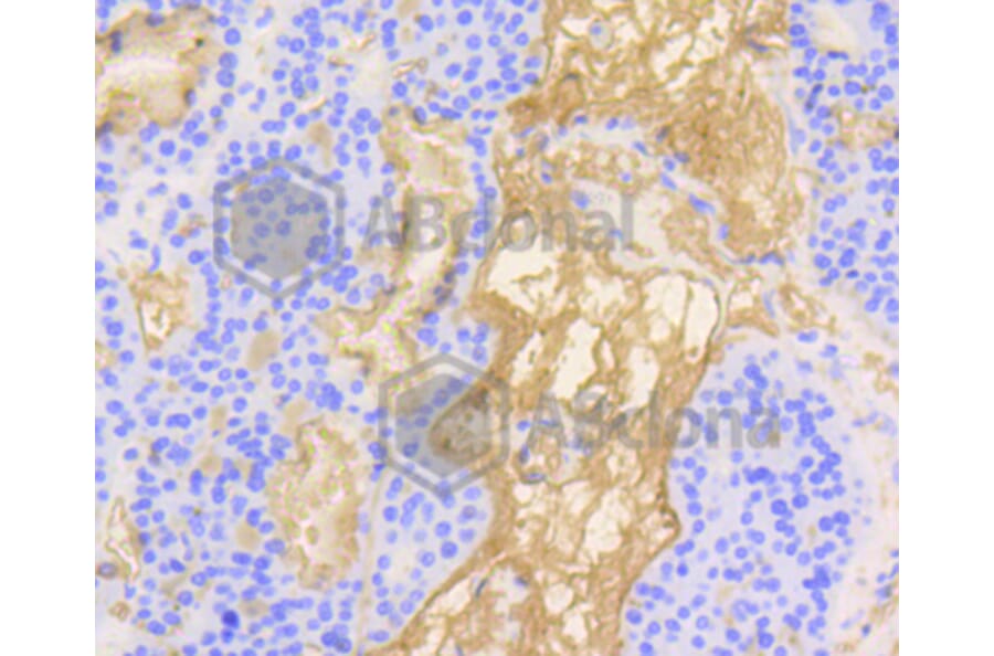 Immunohistochemistry - Anti-VTN Antibody (A11245) - Antibodies.com
