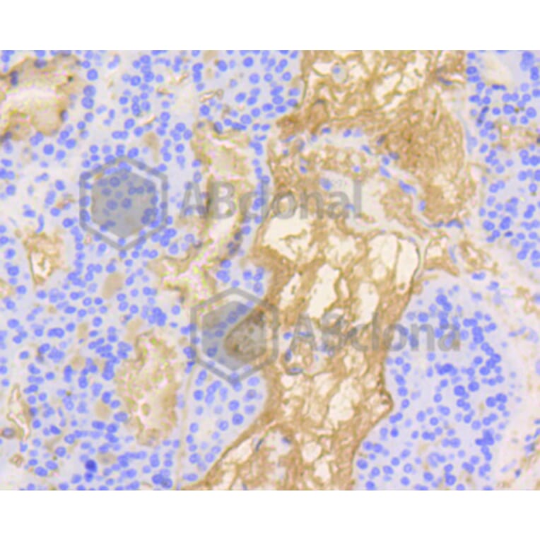 Immunohistochemistry - Anti-VTN Antibody (A11245) - Antibodies.com