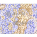 Immunohistochemistry - Anti-VTN Antibody (A11245) - Antibodies.com