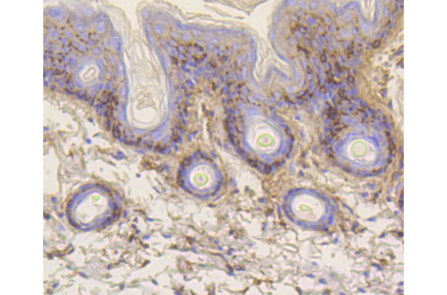 Immunohistochemistry - Anti-VTN Antibody (A11245) - Antibodies.com