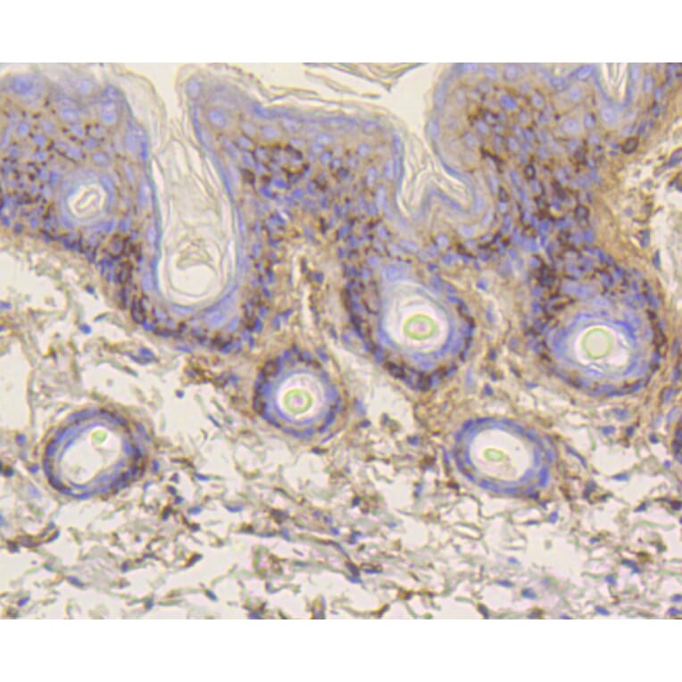 Immunohistochemistry - Anti-VTN Antibody (A11245) - Antibodies.com