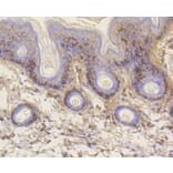 Immunohistochemistry - Anti-VTN Antibody (A11245) - Antibodies.com