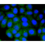 Immunofluorescence - Anti-VTN Antibody (A11245) - Antibodies.com