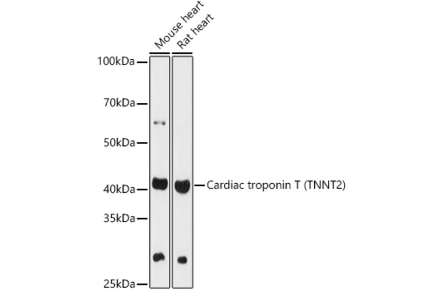 Western Blot - Anti-Cardiac Troponin T Antibody (A13269) - Antibodies.com