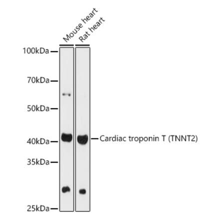 Western Blot - Anti-Cardiac Troponin T Antibody (A13269) - Antibodies.com