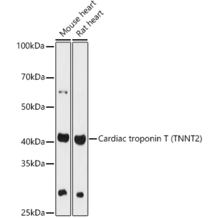 Western Blot - Anti-Cardiac Troponin T Antibody (A13269) - Antibodies.com