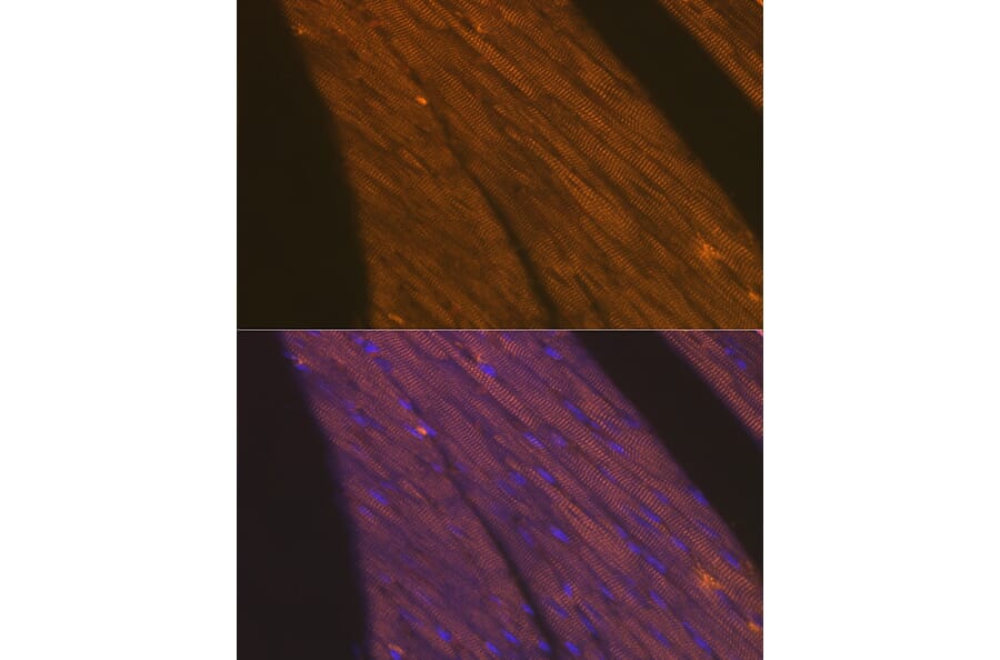 Immunofluorescence - Anti-Cardiac Troponin T Antibody (A13269) - Antibodies.com