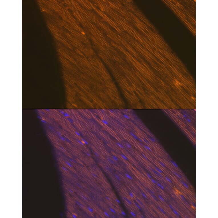 Immunofluorescence - Anti-Cardiac Troponin T Antibody (A13269) - Antibodies.com