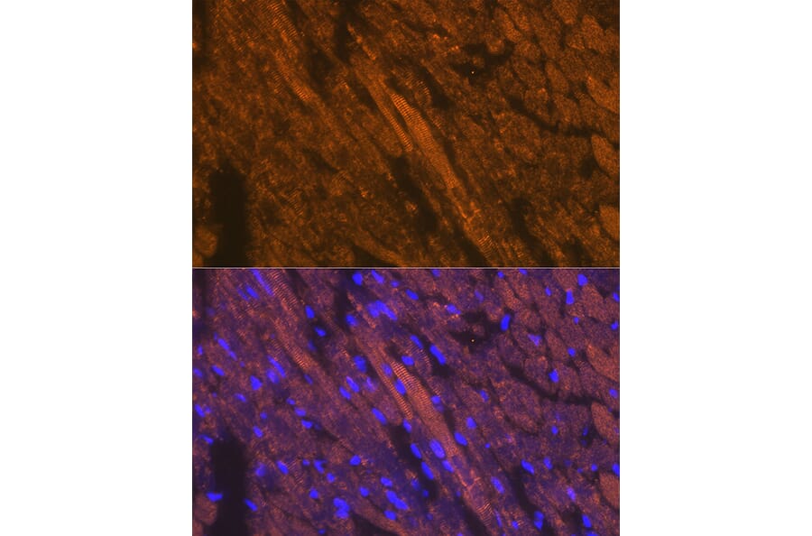 Immunofluorescence - Anti-Cardiac Troponin T Antibody (A13269) - Antibodies.com