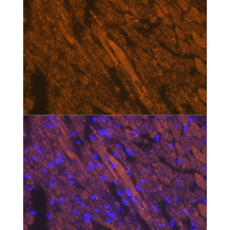 Immunofluorescence - Anti-Cardiac Troponin T Antibody (A13269) - Antibodies.com