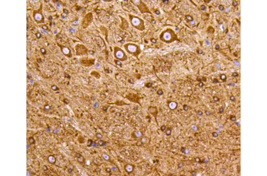 Immunohistochemistry - Anti-PIK3R3 Antibody (A11260) - Antibodies.com