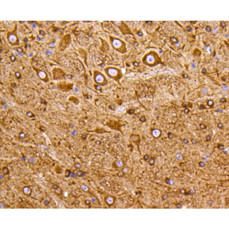 Immunohistochemistry - Anti-PIK3R3 Antibody (A11260) - Antibodies.com