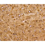 Immunohistochemistry - Anti-PIK3R3 Antibody (A11260) - Antibodies.com