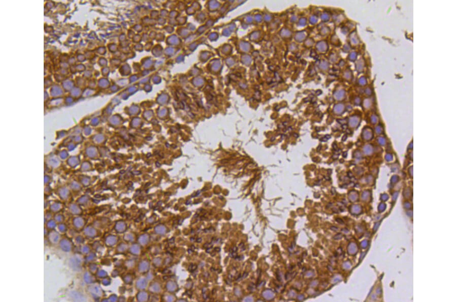 Immunohistochemistry - Anti-PIK3R3 Antibody (A11260) - Antibodies.com