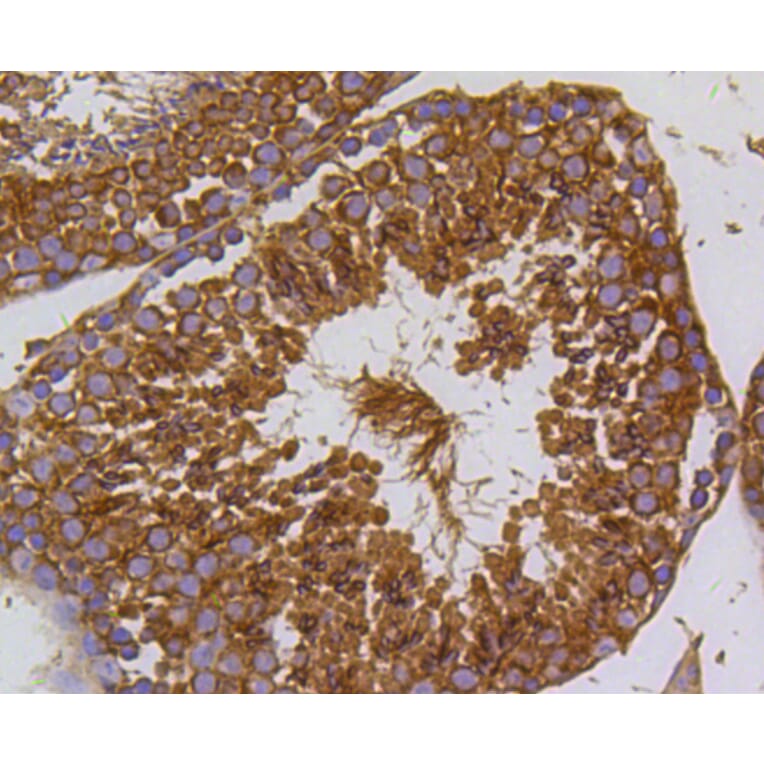 Immunohistochemistry - Anti-PIK3R3 Antibody (A11260) - Antibodies.com