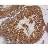 Immunohistochemistry - Anti-PIK3R3 Antibody (A11260) - Antibodies.com