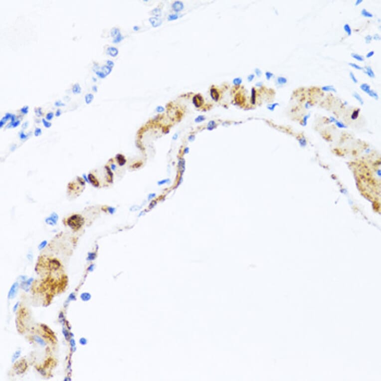 Immunohistochemistry - Anti-PHPT1 Antibody (A13272) - Antibodies.com