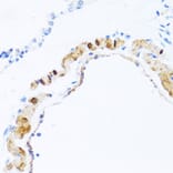 Immunohistochemistry - Anti-PHPT1 Antibody (A13272) - Antibodies.com