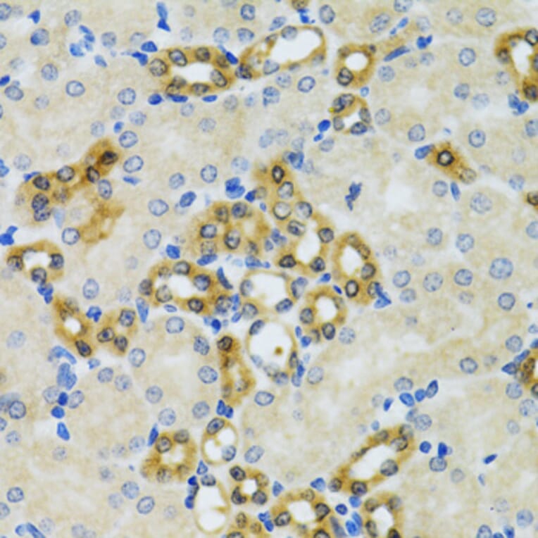 Immunohistochemistry - Anti-PHPT1 Antibody (A13272) - Antibodies.com