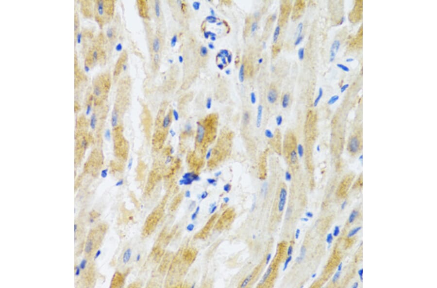 Immunohistochemistry - Anti-PHPT1 Antibody (A13272) - Antibodies.com