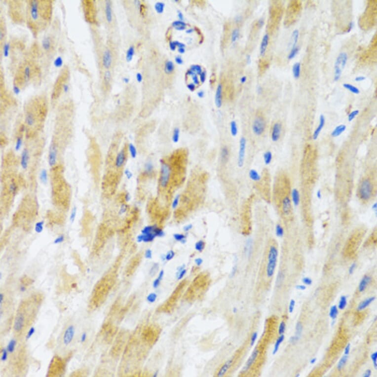 Immunohistochemistry - Anti-PHPT1 Antibody (A13272) - Antibodies.com