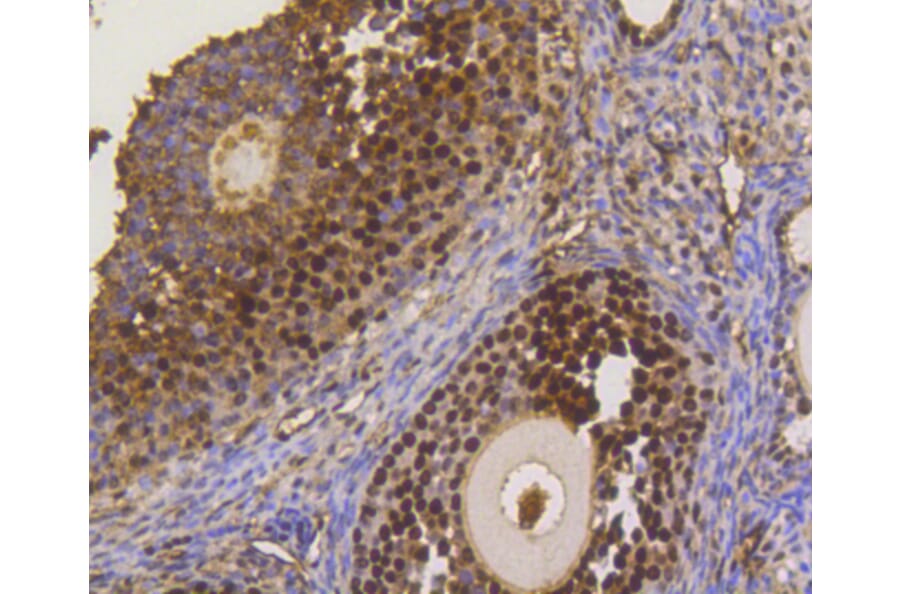 Immunohistochemistry - Anti-ASH2L Antibody (A11278) - Antibodies.com