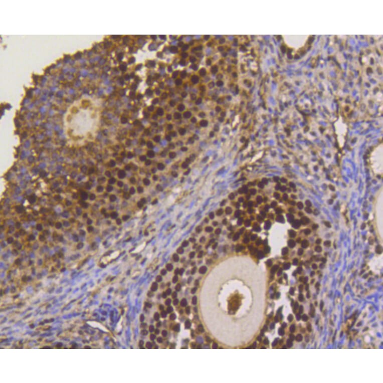 Immunohistochemistry - Anti-ASH2L Antibody (A11278) - Antibodies.com