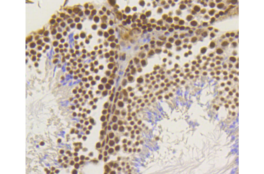 Immunohistochemistry - Anti-ASH2L Antibody (A11278) - Antibodies.com
