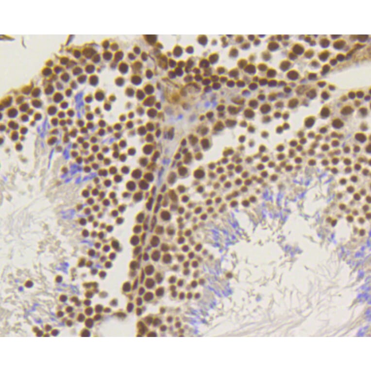 Immunohistochemistry - Anti-ASH2L Antibody (A11278) - Antibodies.com