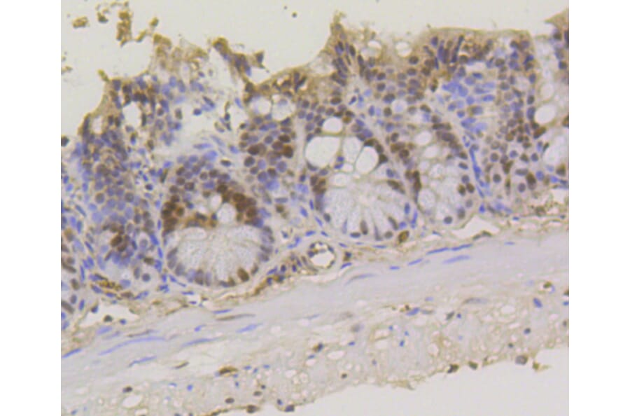 Immunohistochemistry - Anti-ASH2L Antibody (A11278) - Antibodies.com