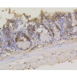 Immunohistochemistry - Anti-ASH2L Antibody (A11278) - Antibodies.com