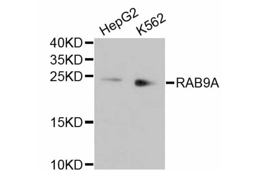 Western Blot - Anti-RAB9A Antibody (A11290) - Antibodies.com