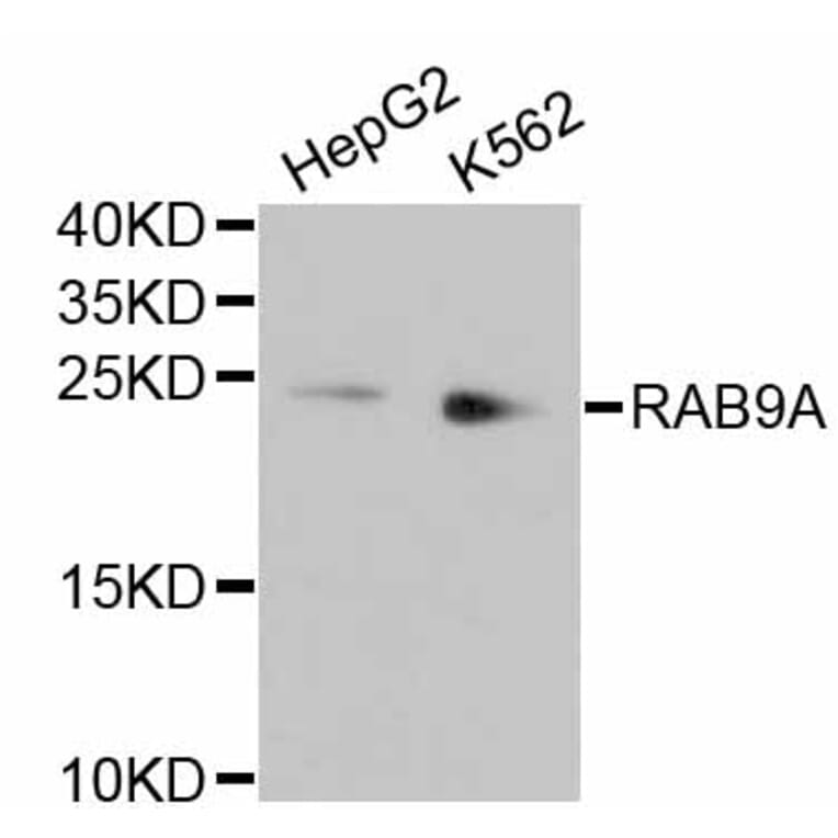 Western Blot - Anti-RAB9A Antibody (A11290) - Antibodies.com