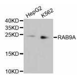 Western Blot - Anti-RAB9A Antibody (A11290) - Antibodies.com