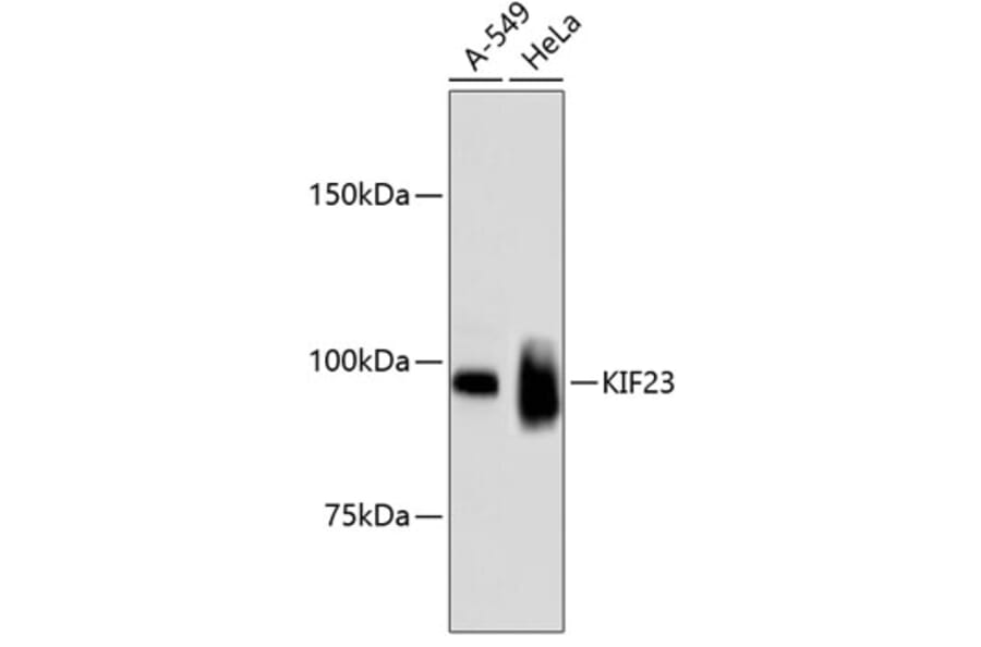 Western Blot - Anti-KIF23 Antibody (A11293) - Antibodies.com