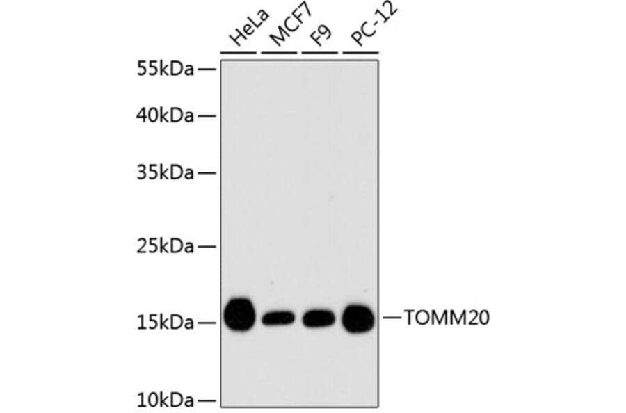 Western Blot - Anti-TOMM20 Antibody (A11308) - Antibodies.com