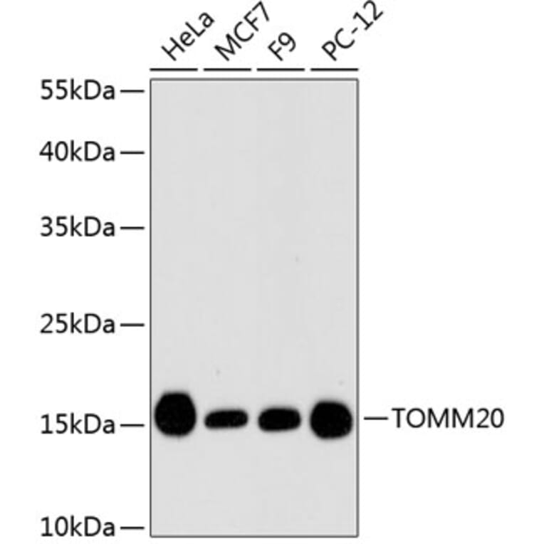 Western Blot - Anti-TOMM20 Antibody (A11308) - Antibodies.com