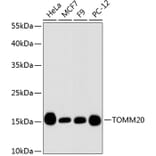 Western Blot - Anti-TOMM20 Antibody (A11308) - Antibodies.com