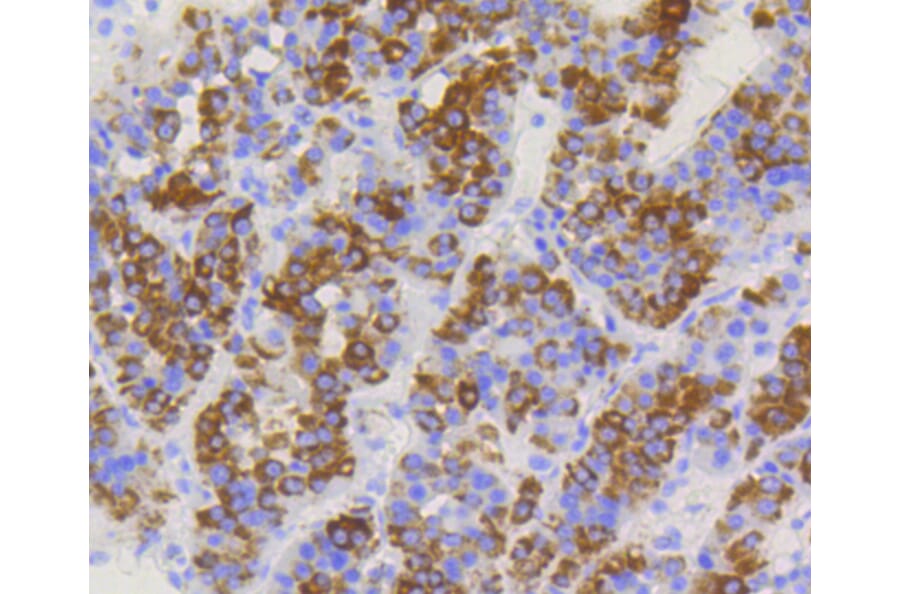 Immunohistochemistry - Anti-TOMM20 Antibody (A11308) - Antibodies.com