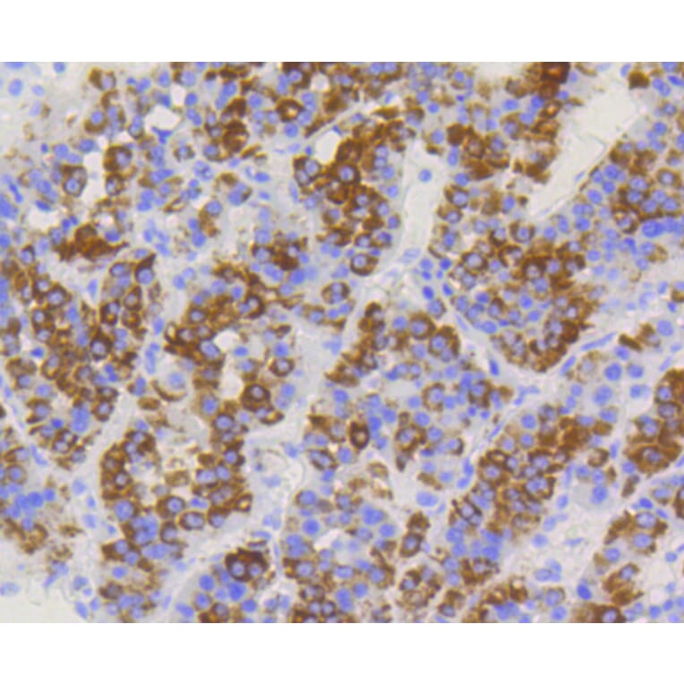 Immunohistochemistry - Anti-TOMM20 Antibody (A11308) - Antibodies.com